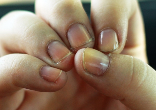 Mmm, look at those disgusting cuticles.